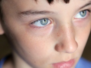 Autism Spectrum Disorder (ASD)